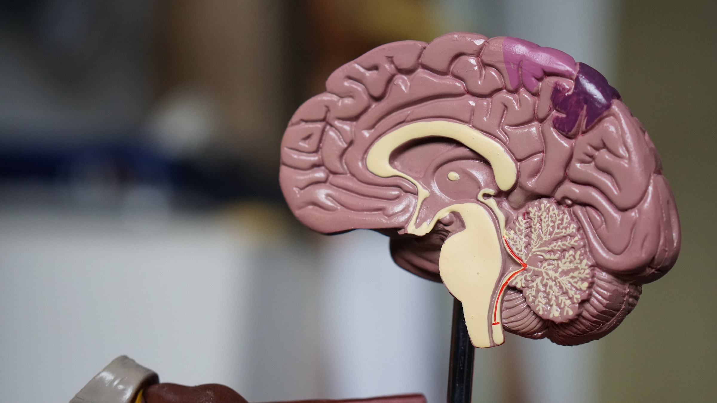 model of a human brain.